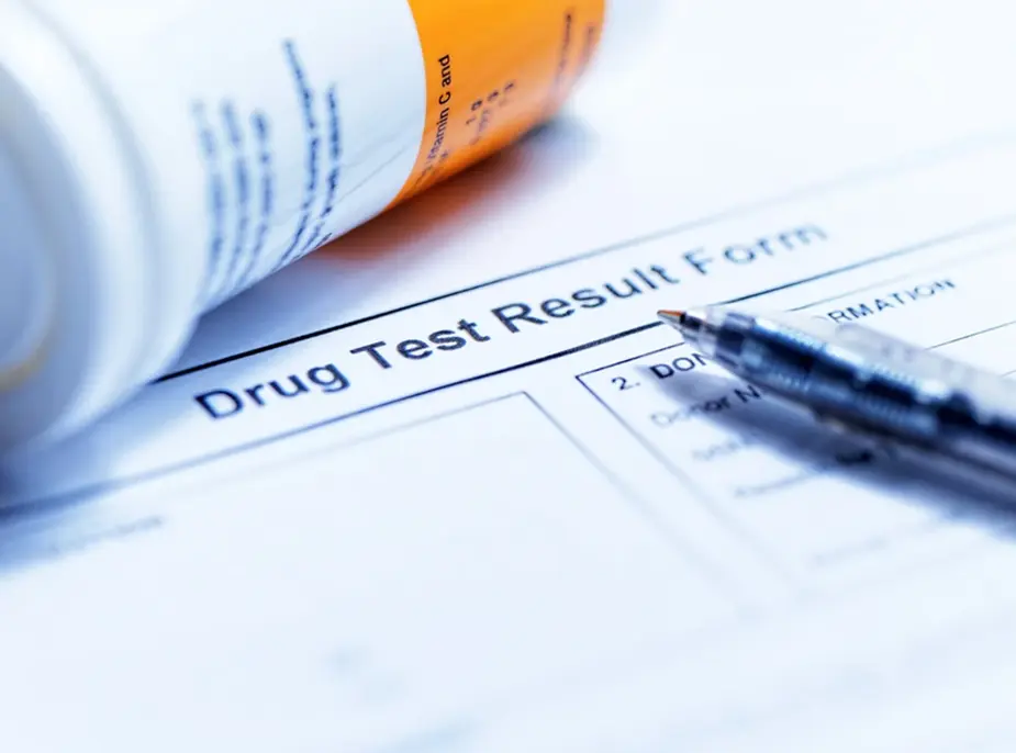 Does Delta 8 THC Show Up On A Drug Test?